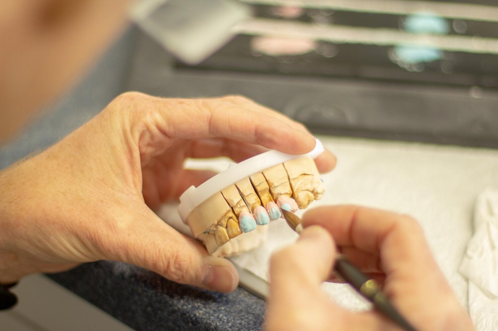 Dental Restoration Method